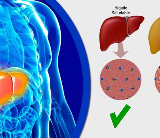 Cum sa curatati ficatul – 8 sucuri 100% eficiente
